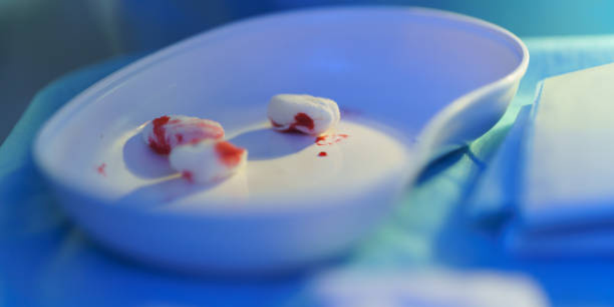 soft foods to eat after tooth extraction